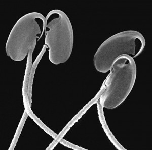 Esperamatozoides de ratón de campo vistos con microscopía electrónica de barrido.
